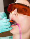 Patient Benefits of Laser Dental Care